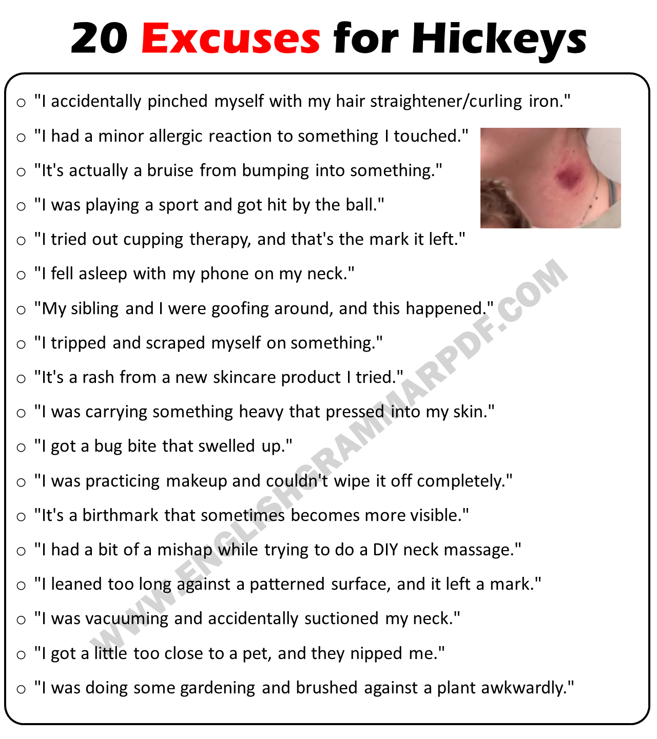 20 Best Excuses For Hickeys